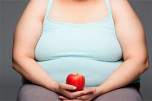 Per curare le vene varicose è necessario perdere peso in eccesso