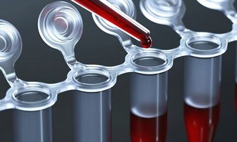 esame del sangue per le vene varicose sulle gambe