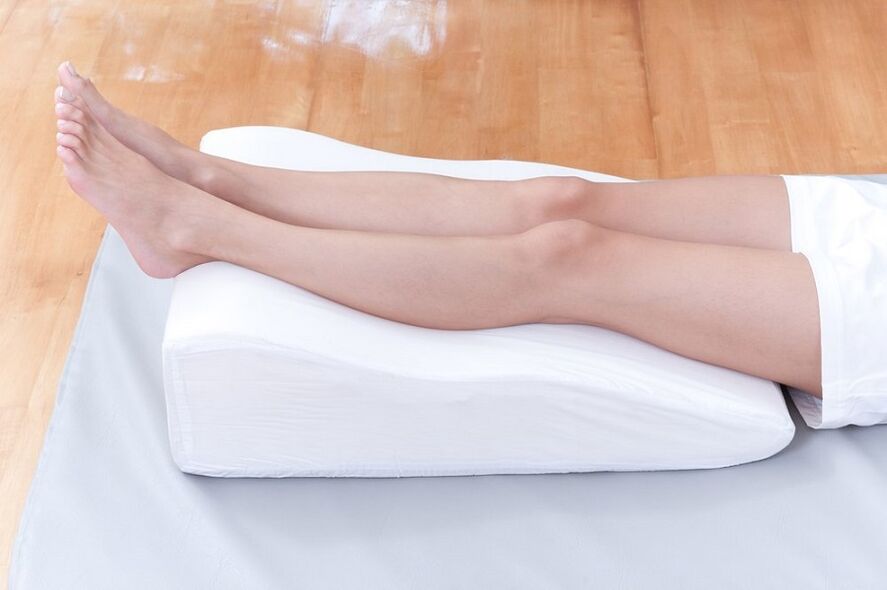 vene varicose sulle gambe